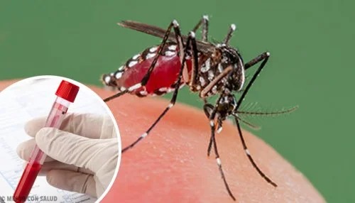 Sistema de control epidemiológico nacional estudia defunción de paciente por probable dengue